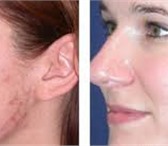 Foto в Красота и здоровье Косметика 3 шага к здоровой и красивой коже1 - Очистите в Москве 990