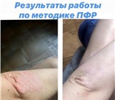 Фото в Красота и здоровье Медицинские услуги МЕТОДИКА PF_R ПОЗВОЛЯЕТ: Избавится от первопричины в Москве 5 000