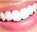 Foto в Красота и здоровье Стоматологии Чтобы иметь красивые зубы – надо ответственно в Ростове-на-Дону 0