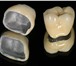 Изображение в Красота и здоровье Стоматологии Установка протезов зубов, протезирование в Калининграде 1
