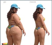 Фотография в Красота и здоровье Массаж Пришла весна.Ни за горами лето.Женский пол в Москве 1 500