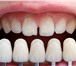 Фото в Красота и здоровье Стоматологии Установка протезов зубов, протезирование в Калининграде 1