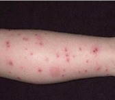 Фотография в Прочее,  разное Разное Занесли в квартиру блох и не можете с ними в Воронеже 2 200