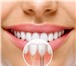 Фото в Красота и здоровье Стоматологии В нашей стоматологической клинике «Саф-Мед» в Москве 29 900