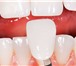 Foto в Красота и здоровье Стоматологии Установка протезов зубов, протезирование в Калининграде 1