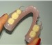 Фотография в Красота и здоровье Стоматологии Установка протезов зубов, протезирование в Калининграде 1