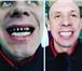 Foto в Красота и здоровье Стоматологии Мы сделаем Вашу улыбку красивой!Лечение зубов в Москве 1 000