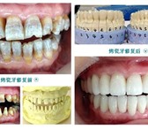 Изображение в Красота и здоровье Стоматологии Мы сделаем Вашу улыбку красивой!Лечение зубов в Москве 2 000