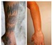 Изображение в Красота и здоровье Косметические услуги - Лазерное удаление татуировок и татуажа, в Уфе 0