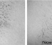 Изображение в Красота и здоровье Косметические услуги Элос эпиляция представляет собой процедуру в Красноярске 500