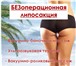 Foto в Красота и здоровье Похудение, диеты Представляем новую революционную процедуру в Кемерово 6 400